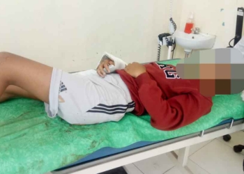 Pembacok Siswa SMPN 3 Gunungjati Ditangkap, Pelaku Juga Masih Pelajar