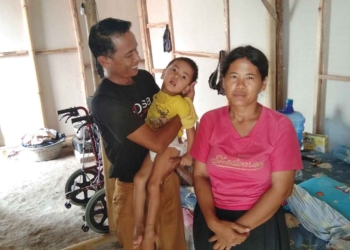 Tidak Miliki Uang untuk EEG dan Beli Sepatu Afo, Orang Tua Balita Penderita CP hanya Bisa Pasrah