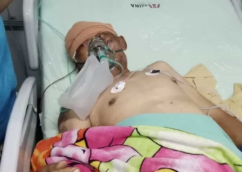 Penganiayaan di Cirebon, Lebih Parah dari Mario Dandy, Grup Fast Cirebon Publis Foto Korban