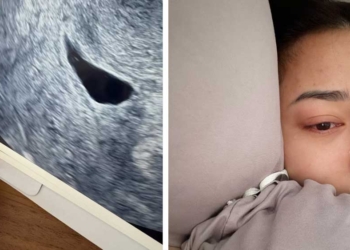 Nikita Willy Keguguran di Usia 7 Minggu, Suami Chat Hadist