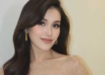 Kronologi Mobil Ayu Ting Ting Dirampok di Las Vegas Amerika