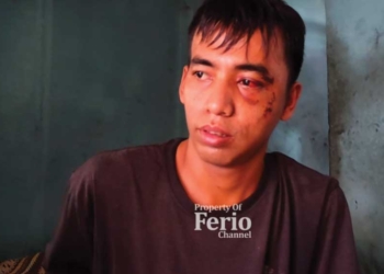 Begini Cerita Aldi Muntah Darah Akibat Ditabrak OTK di Majalengka Saat akan Jadi Saksi Sidang PK Kasus Vina Cirebon