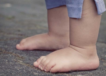 8 Tips Atasi Batuk Anak, Gunakan Bahan Alami dan Aman